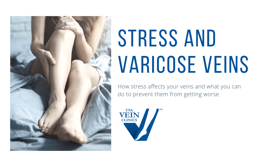 Woman holding her leg with the words "stress and varicose veins."
